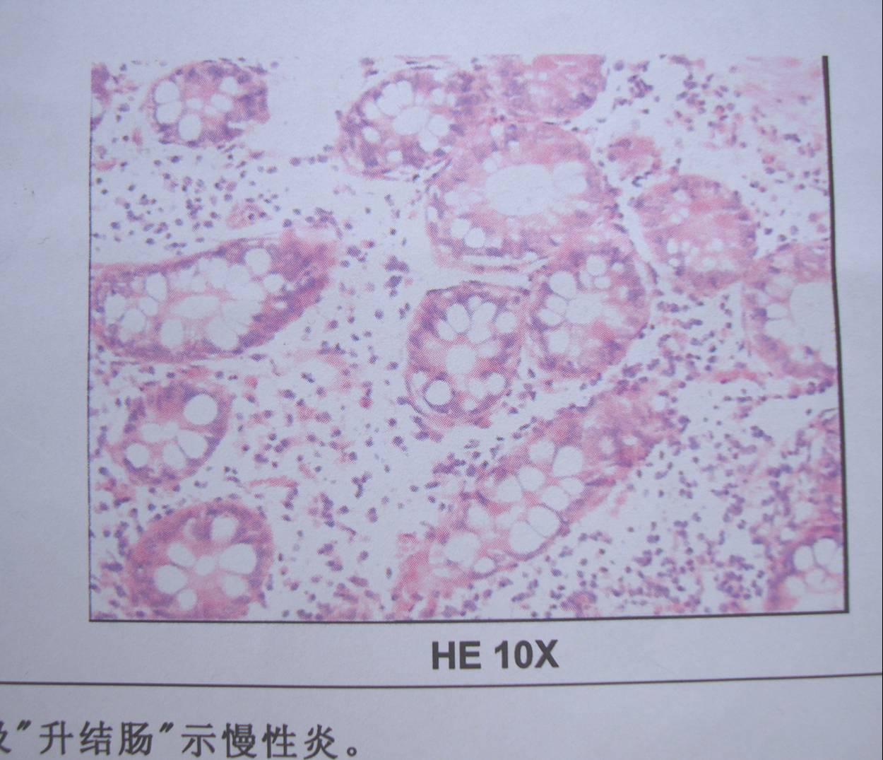 Picture:  A microscopic view of the insides of the man in China. No sign of anything amiss, apparently.  Wuxi, China